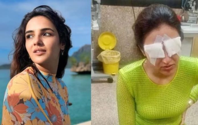 Jasmine Bhasin's Contact Lens Mishap: What Went Wrong and How to Protect Your Eyes